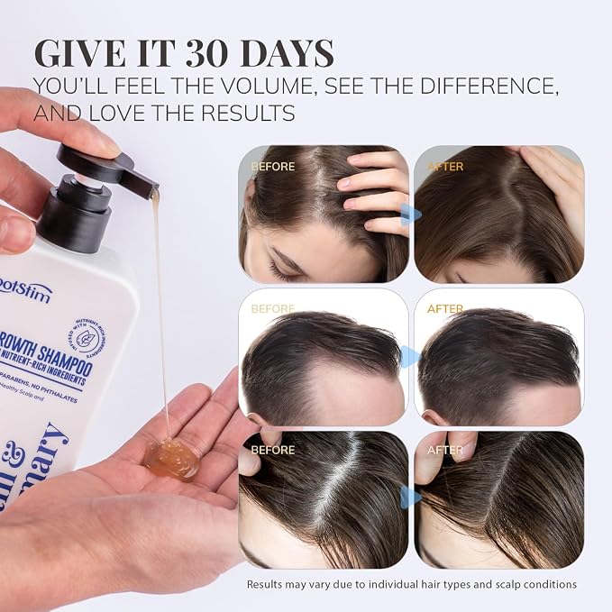 Biotin & Rosemary Shampoo for Hair Growth: Hair Loss Shampoo for Thinning Hair - Image 5