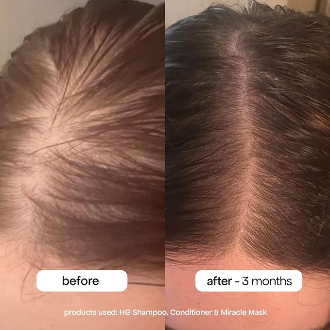 BONDIBOOST HG Anti-Thinning Shampoo - Image 4