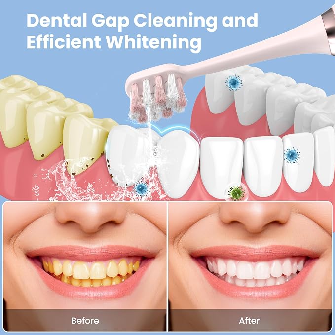 Portable Water flosser with Electric Toothbrush, 2 in 1 Teeth Cleaning Kit - Image 2