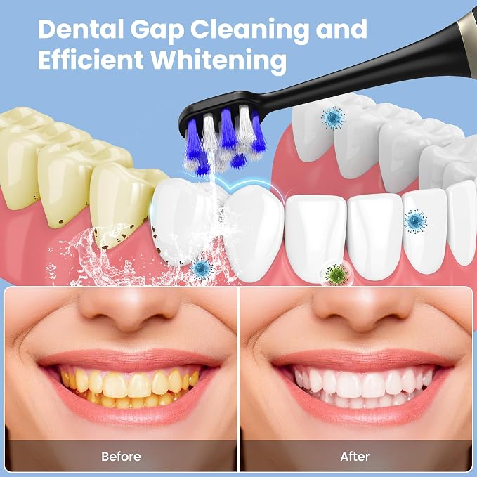 Portable Water flosser with Electric Toothbrush, 2 in 1 Teeth Cleaning Kit - Image 2